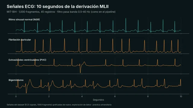 Detección de ECG anormal con RNN y LSTM — 1