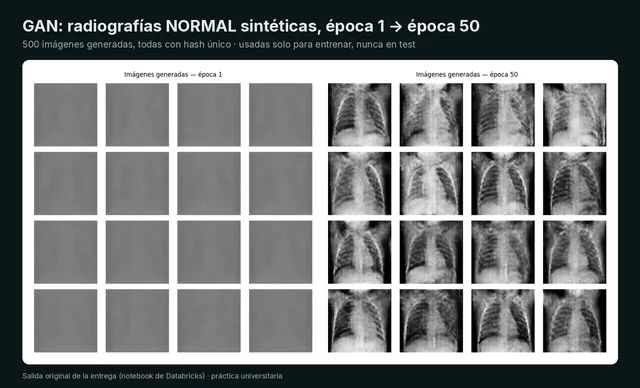 Clasificación de neumonía en radiografías de tórax — 4