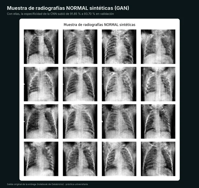 Clasificación de neumonía en radiografías de tórax — 5